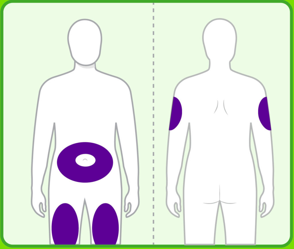 Drawing of human body and where to inject Zepbound